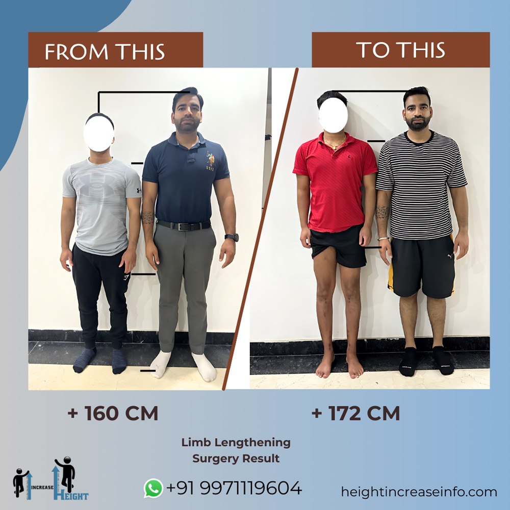 Limb Lengthening Result 1